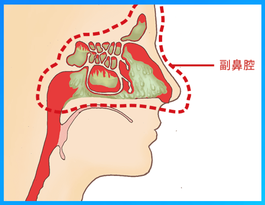 副鼻腔の図。